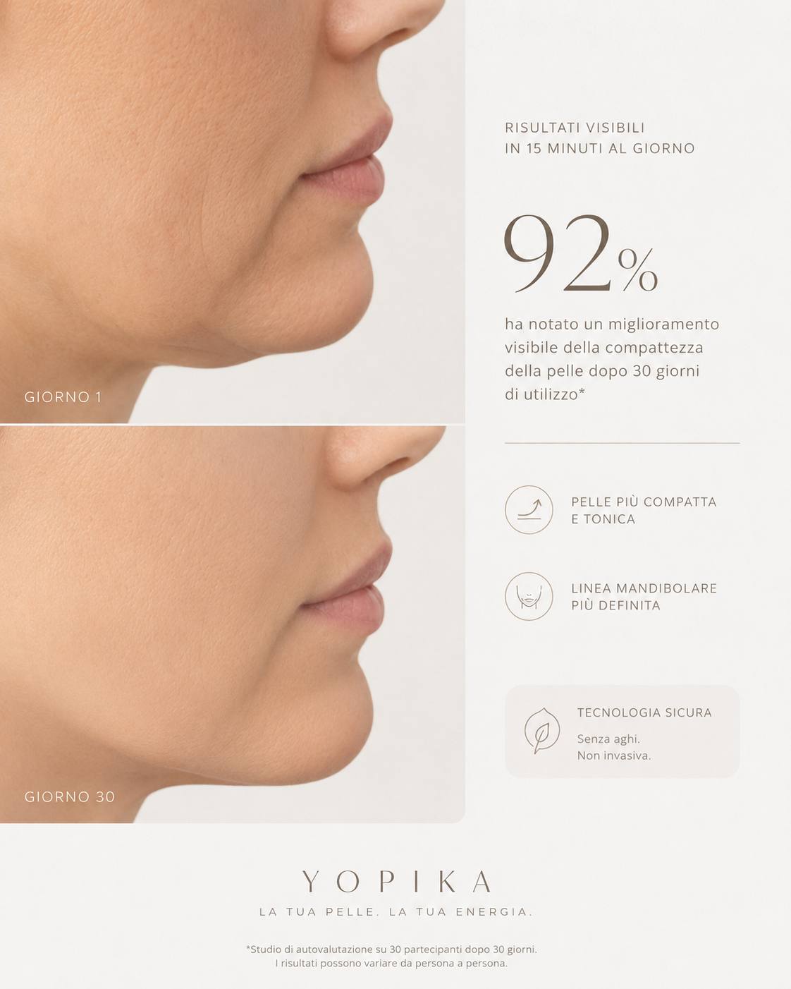 YOPIKA – Kit EMS Effetto Lifting